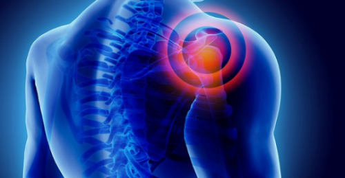 Shoulder-pain-3-540x280